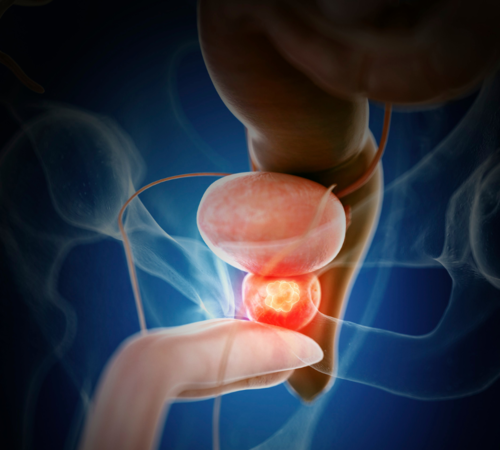 Jakie są objawy prostaty u mężczyzn?